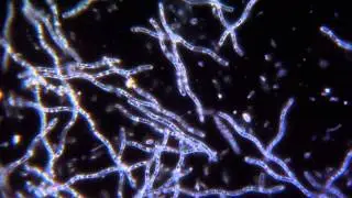 Bacteria Spirillum - Darkfield Microscope