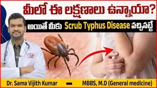 Scrub Typhus Disease Telugu || Scrub typhus Causes, Symptoms and Treatment || One Hospitals