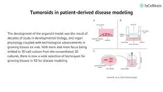 Tumoroids : A Versatile Tool In Disease Modeling