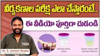 వీర్యం పరీక్ష || Semen Analysis Test Procedure in Telugu || Sperm Test || Andro9 Andrology Hospitals