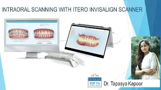 Intraoral Scanning with iTero 3D Invisalign Scanner