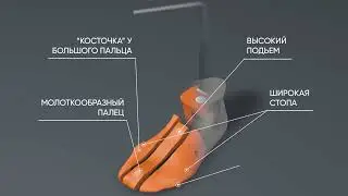 Растяжка обуви. BOTFITTER - точная копия стопы!  Сайт: bootfitter.ru