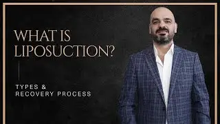 What is Liposuction? - Types & Recovery Process | Assoc. Prof. Daghan Isik
