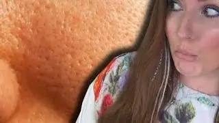 GROBE POREN | Empfindliche Haut | URSACHEN und EINFACHE HILFE | BEAUTY TABU