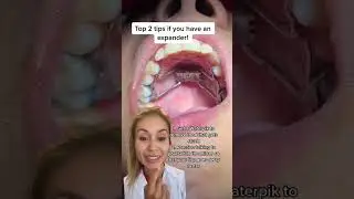 Top 2 Tips If You Have an Expander