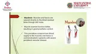 Upper Limb Amputation: Clinical Overview and Rehabilitation Guide