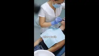 How to relieve pain after a tooth extraction?