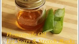 Amazing Homemade Aloevera Oil For Scars And Stretch Marks|Homemade Aloevera Oil Recipe