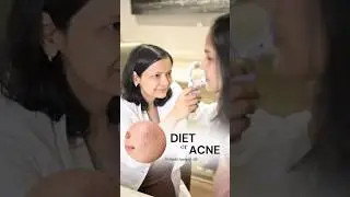 Acne Diet Guide | Acne Prevention Diet by Dermatologist | Dr Ruchi Agarwal | #acne #acneproneskin