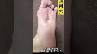 湧泉穴：足少陰腎經之「井穴」Yongquan Point: 