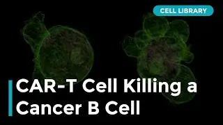 CAR T-cell Killing a Cancer B Cell