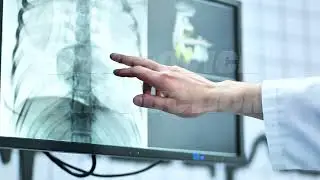 Doctor discussing x-ray image on screen, examining patient diagnosis and medical data