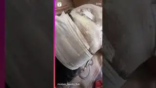 Machinery&rsquo;s facial treatment @muskan beauty hub ❤️ like 👍🏻share🙏 n subscribe my YouTube channel❤️