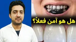 Charcoal Toothpaste &ndash; Is It Safe for Your Teeth?