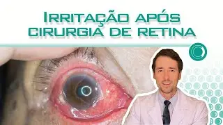 Irritação no olho após cirurgia de retina