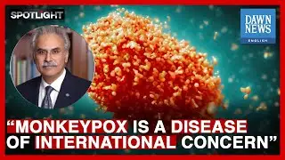 What Is Monkeypox? | Dr Zafar Mirza | Spotlight | Dawn News English