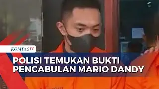 Bukti Kasus Pencabulan Mario Dandy Terhadap AG