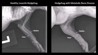 Metabolic Bone Disease april 2018