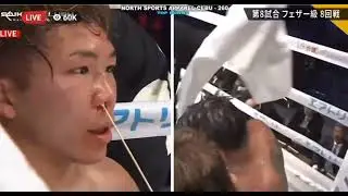 Casimero fight Breakdown against Tom Mizokoshi of Japan.