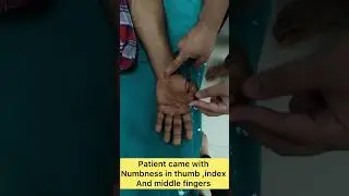 #carpaltunnel#carpaltunnelsyndrome#carpaltunnelrelief#mediannerve#neuropathyrelief#compression#nerve