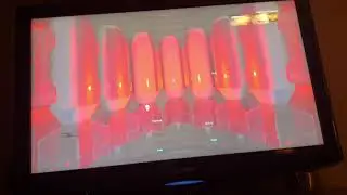 COD Team Match: He got shot in the butt
