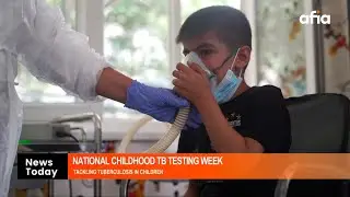 NATIONAL CHILDHOOD TB TESTING WEEK: EXPERTS TACKLE TUBERCULOSIS IN CHILDREN WITH FRESH STRATEGIES