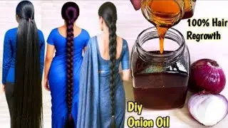 Diy Onion Oil For Hair Regrowth/On the Doctors Advice, I Mixed This With Onion and Applied it...