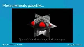 4D-Mode Imaging from FUJIFILM VisualSonics