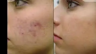 Я Меняюсь Проект Чикаго с Дианой Терлетской Enigma Skin Care