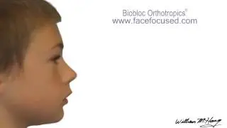 Dr. Hang's Biobloc Orthotropic &reg; Treatment - Morph