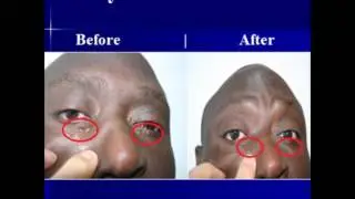 LASER TREATMENTS - LASER  CLINIC  CAPE TOWN   SOUTH AFRICA