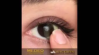 Medeo Lens Ring Green