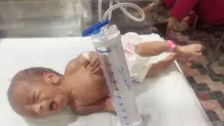 How to Insert IV Line in Newborn Baby in NICU | NICU Nursing Care