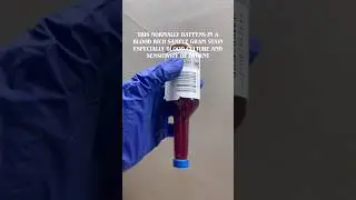 Ghost cells in blood culture sensitivity sample | gram stain | #doctorsofyoutube #microbiology