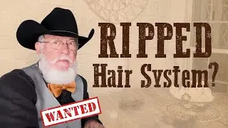 Rick&rsquo;s Hair Transplant Fix To Save His Torn Hair System