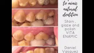 VITA ENAMIC stain and glaze