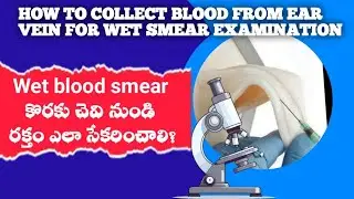 How to collect blood from ear vein for wet film Examination #microfilaria