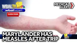 Marylander has confirmed case of measles
