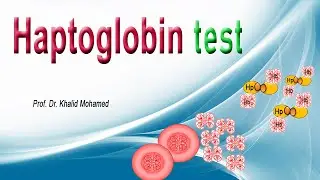 Haptoglobin Test تحليل هابتوجلوبين