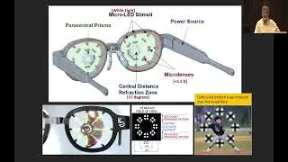 AIOC 2023 IC400 topic Dr  DESAI SANJIV Myopic Defocus and the DIMS, HALT & Kubota glasses