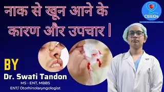 नाक से खून आने के कारण और उपचार | Dr. Swati Tandon ENT Specialist