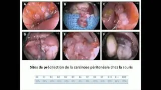 Carcinose, Angiogen&egrave;se, Recherche translationnelle