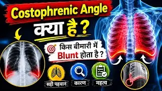 costophrenic angle | How to Identify costophrenic angle on x ray chest