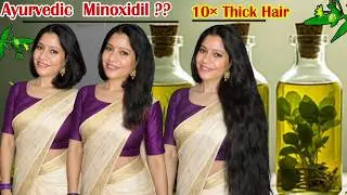 Homemade Ayurvedic Minoxidil Serum To Get 10&times;Thick Hair & To Regrow Hair  ।Garima Singh ।