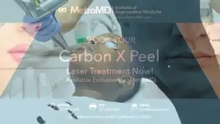 Carbon X Peel! Now Available EXCLUSIVELY at MetroMD! #PeelSeason w/ Destiny Godly