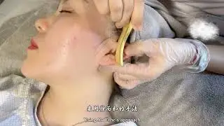 中医特色疗法-耳部全息铜砭刮痧  Ear Holistic Scraping Therapy with Bronze Tool