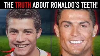 Cristiano Ronaldo Amazing Teeth Transformation - Whats the secret?