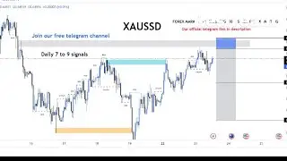XAU/USD.BTC/USD Live trading session  / 25.01.2026 #xauusd #btcusd #gold #forex #nfp #cpi #stocks