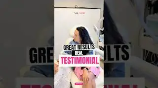 Great results at GC Skin Medspa near Sherman Oaks #gcskin #naturalresults #glow #testimonial