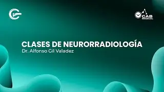 Curso de Neurorradiología - TUMORES DE ENCÉFALO DIAGNOSTICO